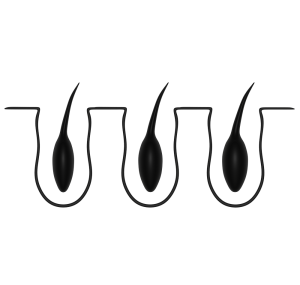 脱毛前の毛穴断面のイラスト