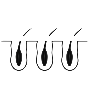 剃毛した毛穴断面のイラスト