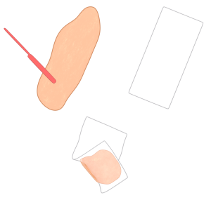 ワックス脱毛のイラスト