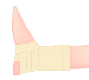 足首にテーピングを巻くイラスト