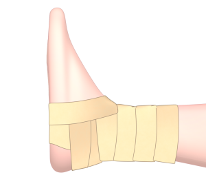 足首にテーピングを巻くイラスト