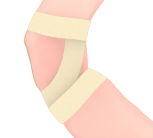 足にテーピングを巻くイラスト